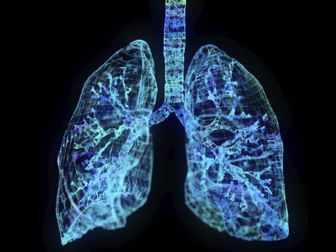 COPD with Chronic Bronchitis - Pulmonology Clinic in Haverhill, MA 01835